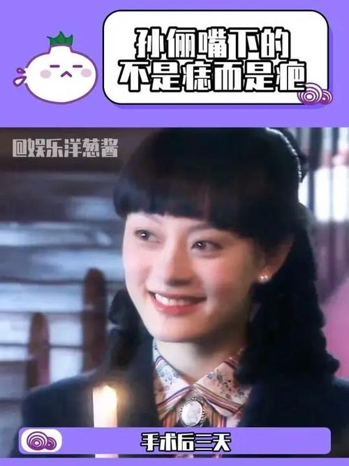 新澳门四肖八肖期期准最新版本,和孙俪唇下痣没了与孙俪嘴唇的痣