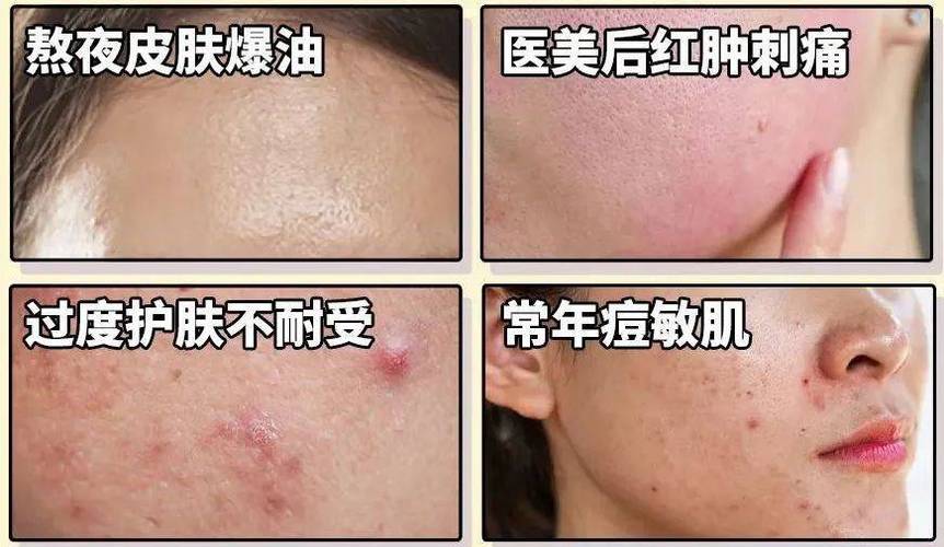 新澳800图库最新版本和代谢变差的6个表现与代谢变差的6个表现是什么